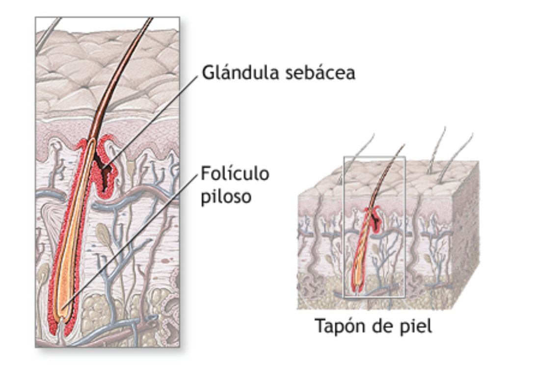 qué es un folículo piloso