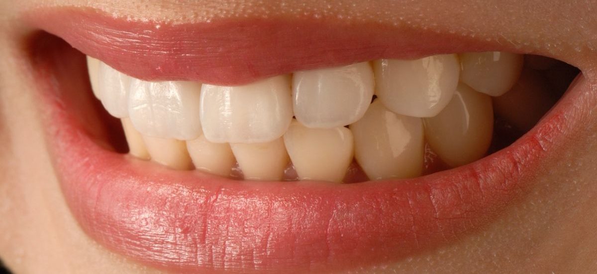 limpieza dental por ultrasonido riesgos
