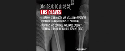 osteoporosis infografía