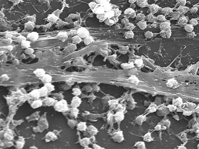 Biofilms En Seguridad Alimentaria Consumer